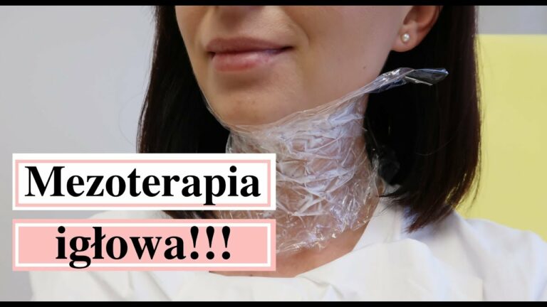 MEZOTERAPIA IGŁOWA – CO WARTO O NIEJ WIEDZIEĆ!