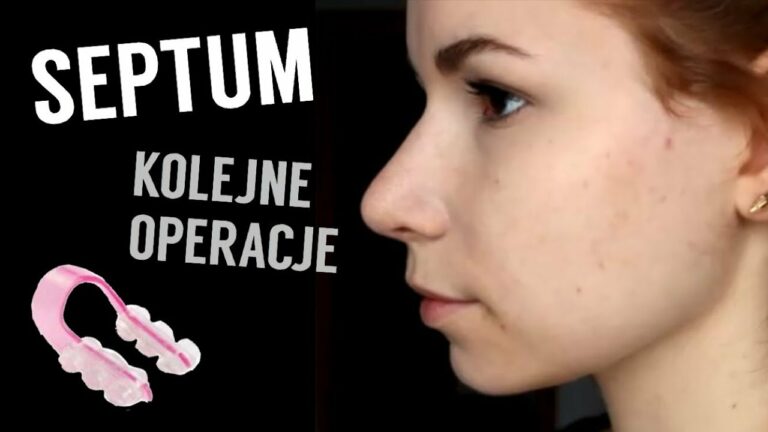 OPERACJA PLASTYCZNA NOSA // PIERCING SEPTUM | CO BYM ZMIENIŁA | KLIPS ZMNIEJSZAJĄCY NOS | Q&A