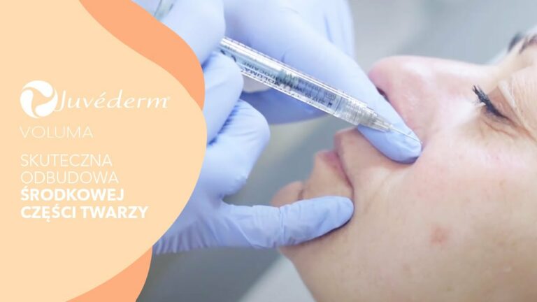 Skuteczna odbudowa środkowej części twarzy – JUVEDERM VOLUMA ® | Klinika VESUNA