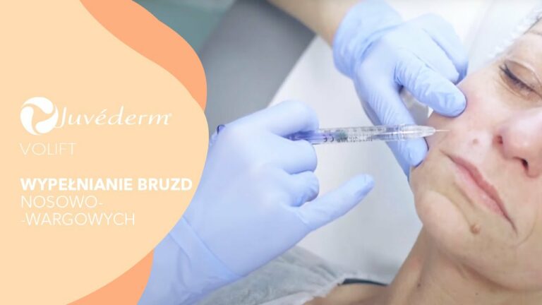 Wypełnianie bruzd nosowo-wargowych – JUVEDERM® VOLIFT | Klinika VESUNA