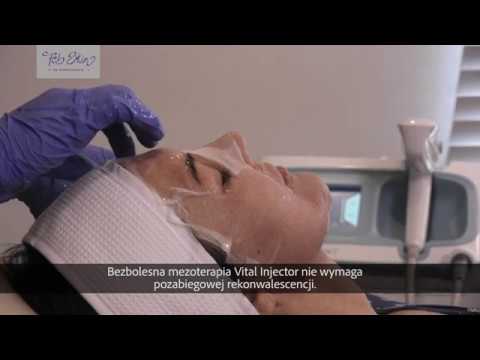 Bezbolesna mezoterapia igłowa Vital Injector