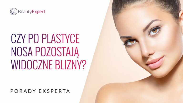 Czy po plastyce nosa pozostają widoczne blizny? Porady eksperta