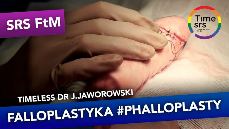 #Falloplastyka #Phalloplasty (korekta płci SRS FtM) zabieg przeprowadzany przez dr J. Jaworowskiego