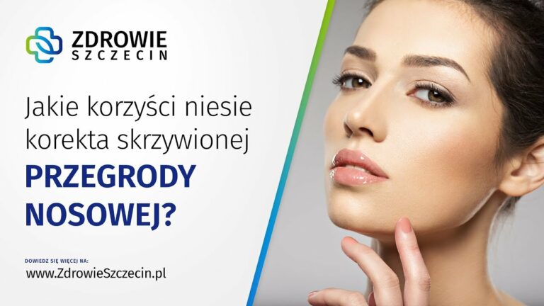 Jakie korzyści niesie korekta skrzywionej przegrody nosowej? – Zdrowie Szczecin