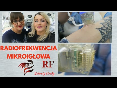 Lifting twarzy, odmładzanie, usuwanie blizn, rozstępów-RADIOFREKWENCJA MIKROIGŁOWA RF