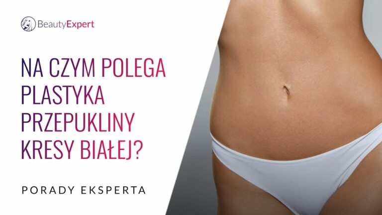 Na czym polega plastyka przepukliny kresy białej? Porady eksperta