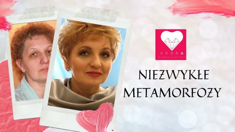 Niezwykłe Metamorfozy Urody. Cofnij z nami czas | Centrum Uroda Wrocław | dr Monika Lelonkiewicz