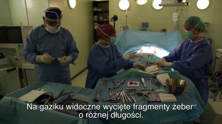 Operacja garbu żebrowego dr n. med  Paweł Michalski na www.skolioza.org