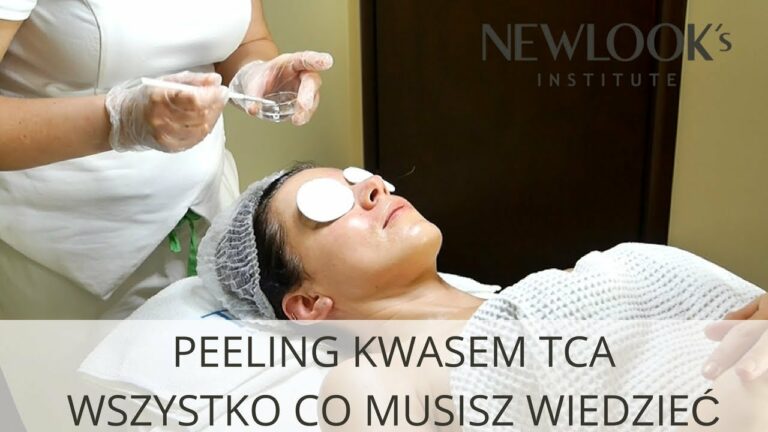 Peeling kwasem TCA – wskazania, przebieg i efekty peelingu chemicznego