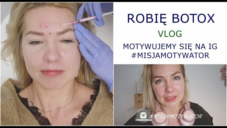 ROBIĘ BOTOX i #MISJAMOTYWATOR ? VLOG  ? PRAWIE idealna