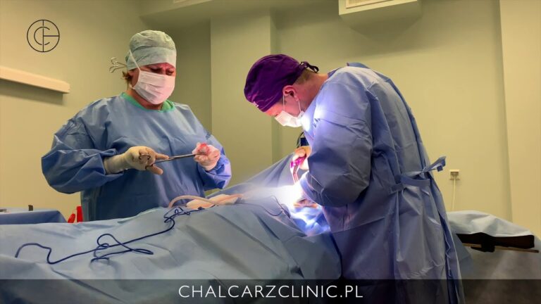 Usuwanie preparatu AQUAfilling® z piersi – chalcarzclinic.pl