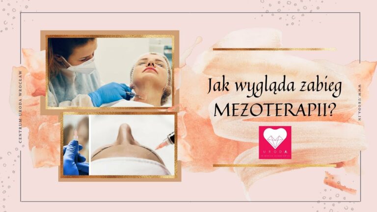 Zabieg Mezoterapii. Dr n.med. Monika Lelonkiewicz, Centrum Dermatologii i Laseroterapii Uroda