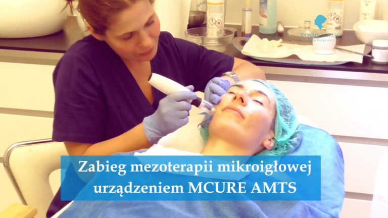 Zabieg mezoterapii mikroigłowej urządzeniem MCURE AMTS