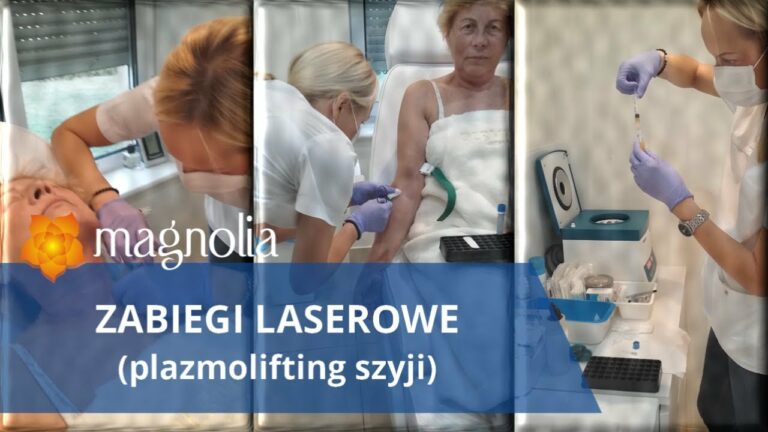 Zabiegi laserowe Łódź :: Osocze bogatopłykowe oraz plazmolifting szyji