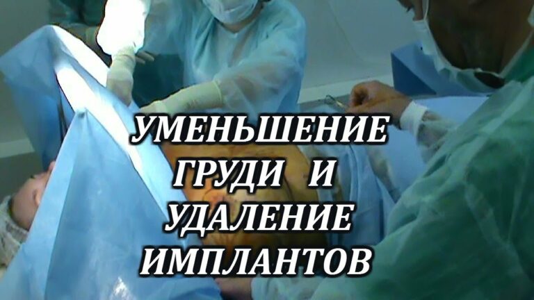 Редукционная маммопластика с удалением имплантов.Хирург Гайнуллин Р.М.Общая анестезия Марк Бакаушин