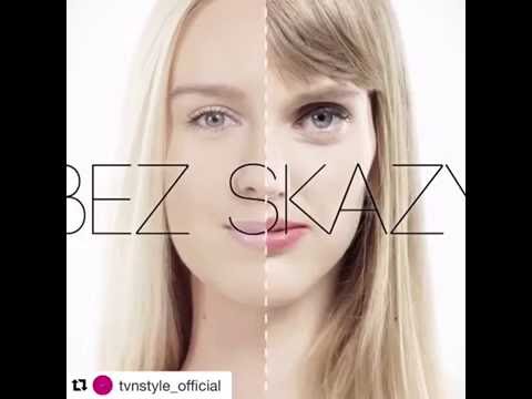 Bez Skazy Odcinek 4