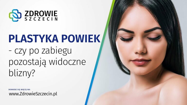 Czy plastyka powiek pozostawia widoczne blizny? – Zdrowie Szczecin