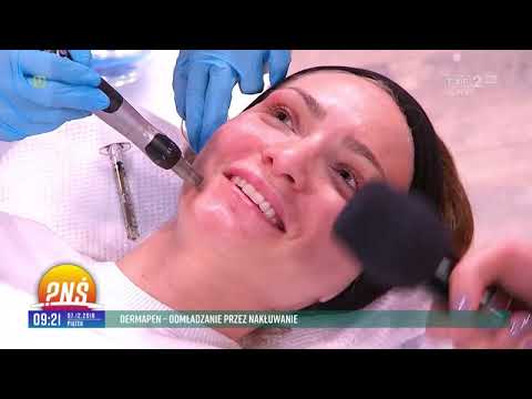 Dermapen – ODMŁADZANIE PRZEZ NAKŁUWANIE