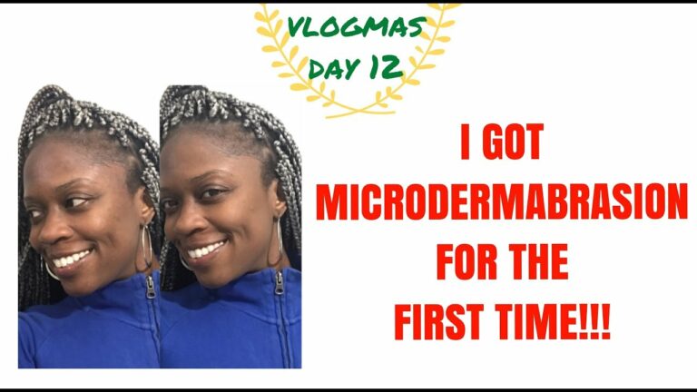 I GOT THE MICRODERMABRASION FOR THE FIRST TIME!! | HOLIDAY SKIN | MY THOUGHTS | VLOGMAS DAY 12