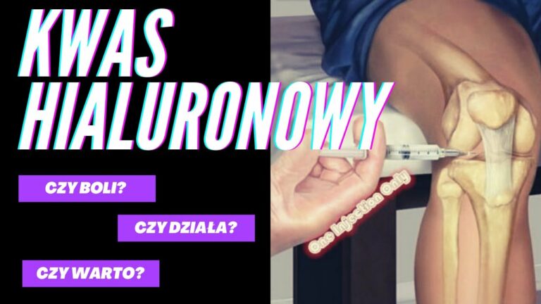 Kwas Hialuronowy- moje doświadczenia. Czy boli? Czy warto?