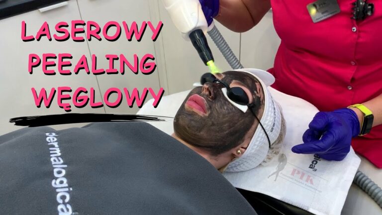 Laserowy peeling węglowy w Poznański Instytut Kosmetologii