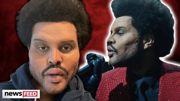 The Weeknd Debuts WILD Plastic Surgery Look & Fans Are Shocked!