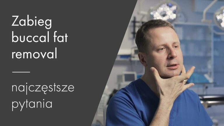 Usuwanie poduszek Bichata (Buccal Fat Removal) – najczęstsze pytania