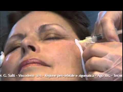 Viscoderm 1,6% 30 Needle Dr Salti