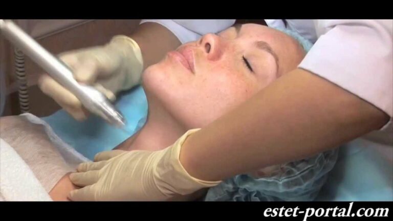 Гидропиллинг на аппарате HydraFacial. estet-portal.com