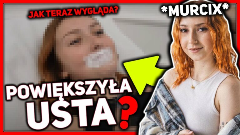 MURCIX POWIEKSZYŁA USTA *JAK WYGLĄDA?* #shorts