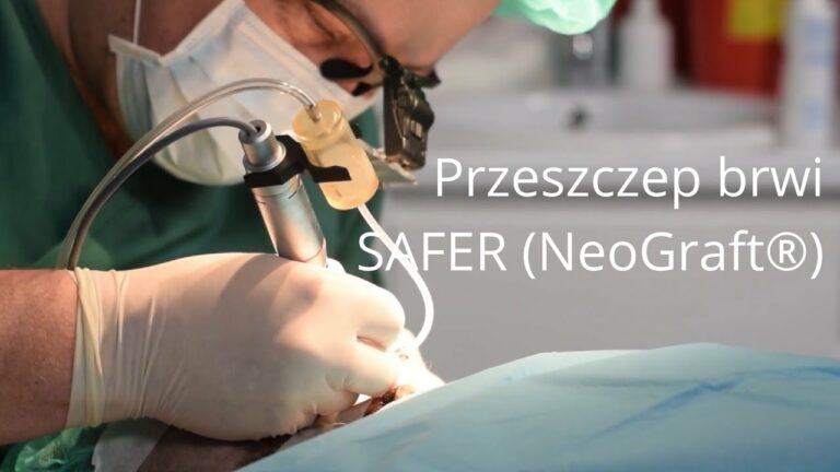 Przeszczep brwi SAFER (NeoGraft®) w Perfect Hair Clinic