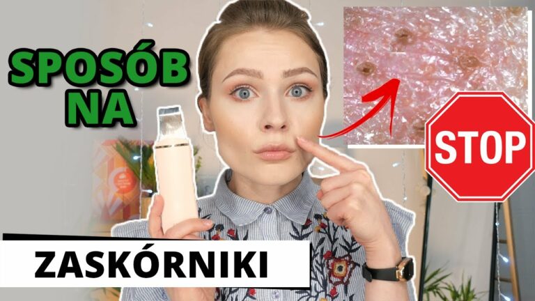 ZASKÓRNIKI ? ❌ POZBĄDŹ się ICH ❌ Peeling Kawitacyjny w Domu ? INSTRUKCJA * ZABIEG * EFEKTY ? Pondi