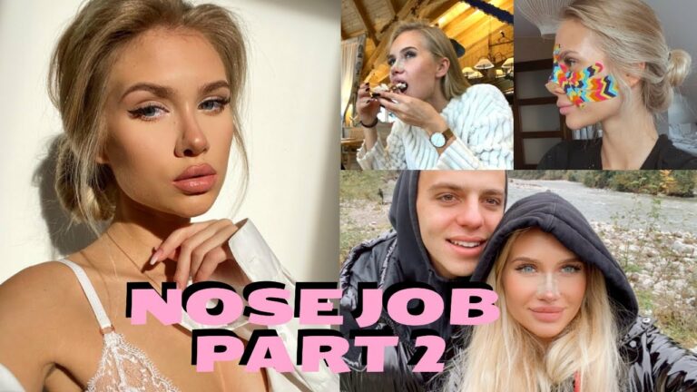 NOSE JOB PART 2/operacja poprawkowa