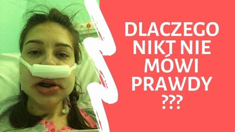 Najczęstsze powikłania po operacji szczęki. Czy możesz UMRZEĆ? #27