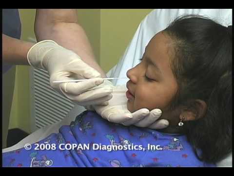 How to Collect Nasopharyngeal Samples for Flu Testing Using COPAN Flocked Swabs