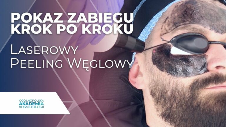 Laserowy peeling węglowy step by step Pokaz | Krok po Kroku | Ogólnopolska Akademia Kosmetologii