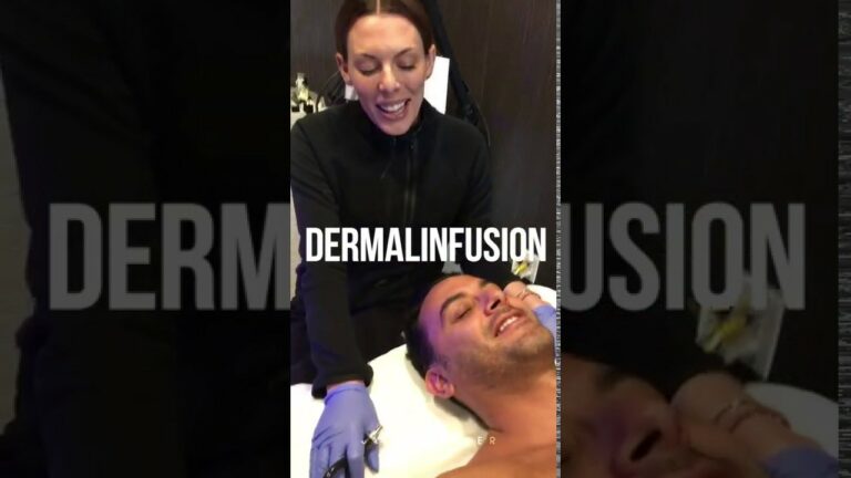 DERMALINFUSION Skin Resurfacing Treatment | Microdermabrasion |  Live