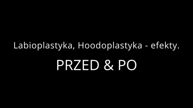 #Hoodoplastyka & #Labioplastyka (zdjęcia Przed i Po) – Estei.pl, Agnieszka Ledniowska, Laboca Clinic