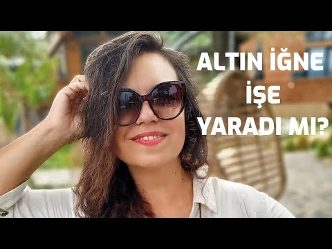 ALTIN İĞNE FRANKSIYONEL CİLT BAKIMINDAN MEMNUN KALDIM MI ? ( PARİS IŞILTILI) FRAKSİYONEL