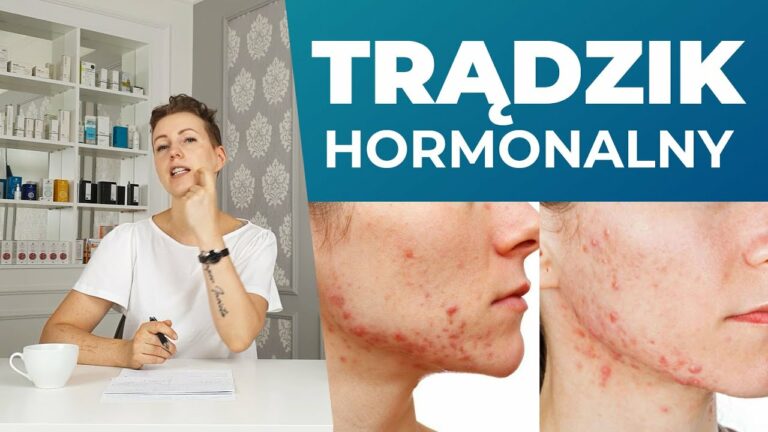 Co pomaga na trądzik hormonalny – bolesne wypryski na żuchwie i szyi? / Saga o trądziku cz. 5