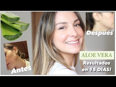 Como usar ALOE VERA en el rostro RESULTADOS en 15 Dias!