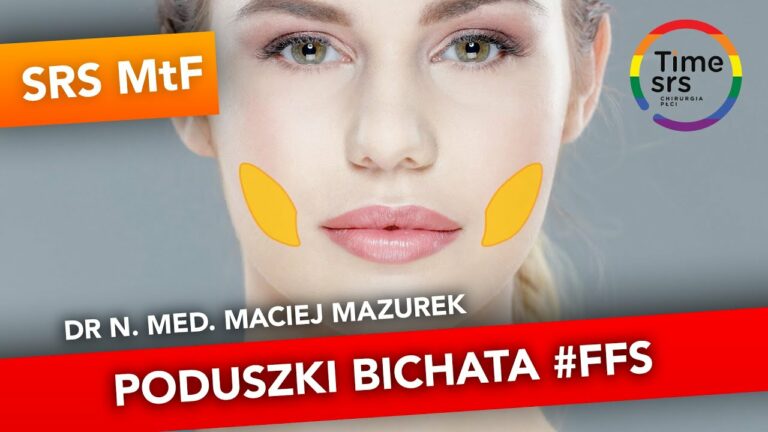 Feminizacja policzków – redukcja poduszek tłuszczowych #Bichata #FFS