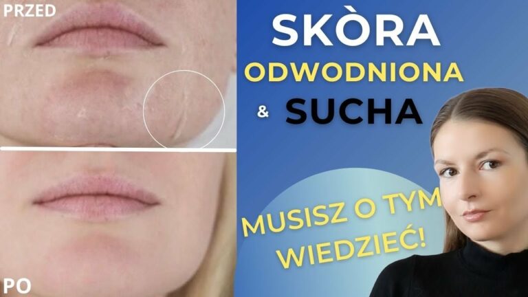 Skóra Sucha i Odwodniona – pielęgnacja