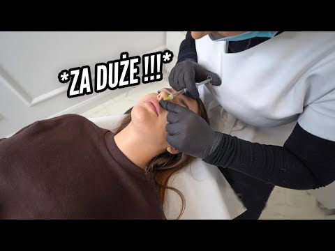 VLOGMAS #7 ZROBIŁA ZABIEG O KTÓRYM MARZYŁA *REAKCJA*