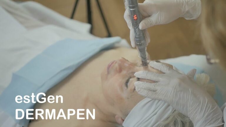 estGen + dermapen – zabieg odmładzający – antiageing skin facial