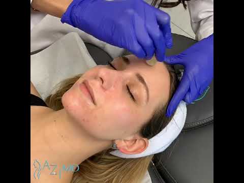 AquaGold Micro Infusion Gold Facial