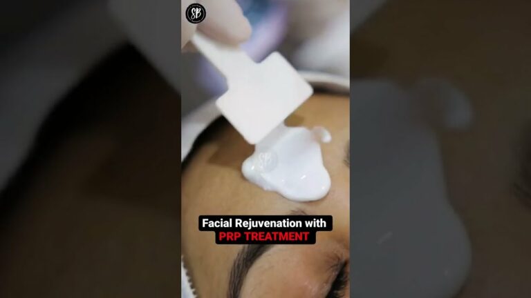 Face Rejuvenation with PRP Treatment | #skinrejuvenation #prp #prpforface #shorts #youtubeshorts