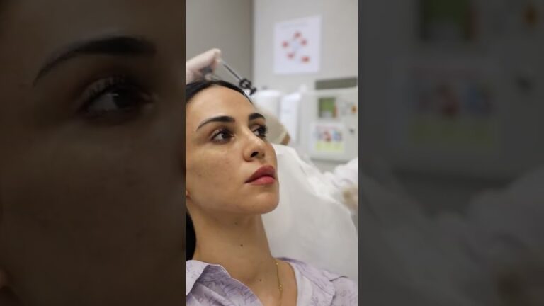 Facial Dermal Fillers تحديد الوجه بالفيلر