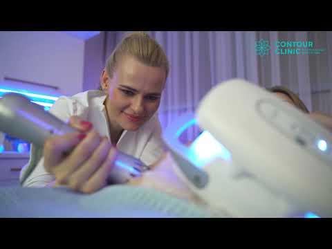 KRIOLIPOLIZA 3 Zimmer ZLipo. CONTOUR CLINIC Kosmetologia i Medycyna Estetyczna Wrocław