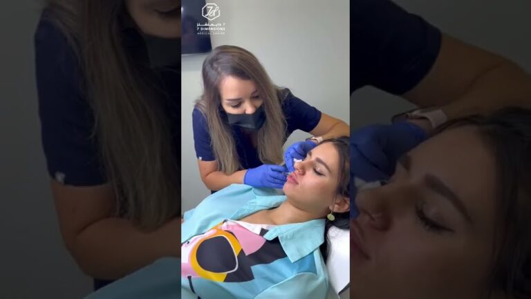 Lip filler injection | natural look | cosmetic Dermatology | Dubai